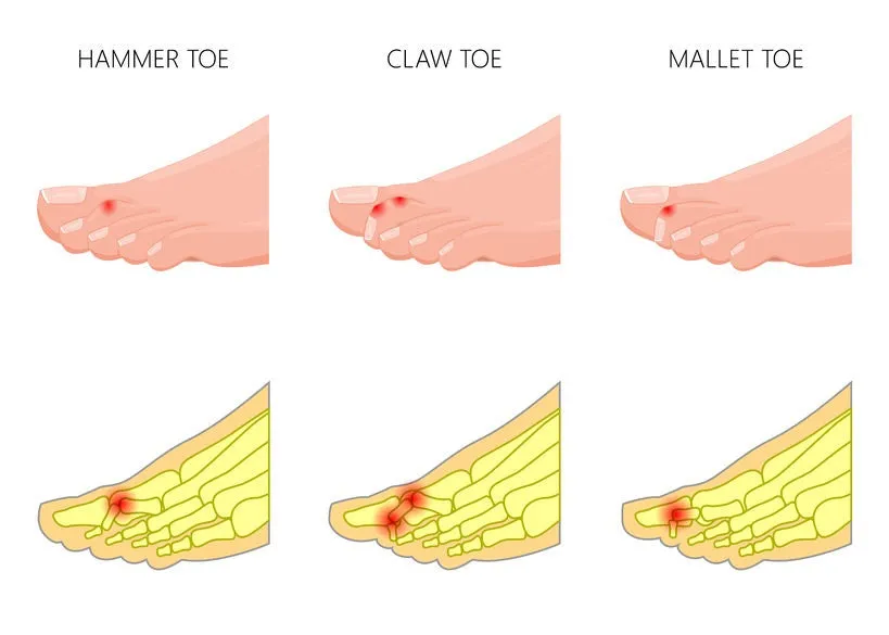 12 CE Foot Reflexology Basics with Advanced Medical Foot Massage